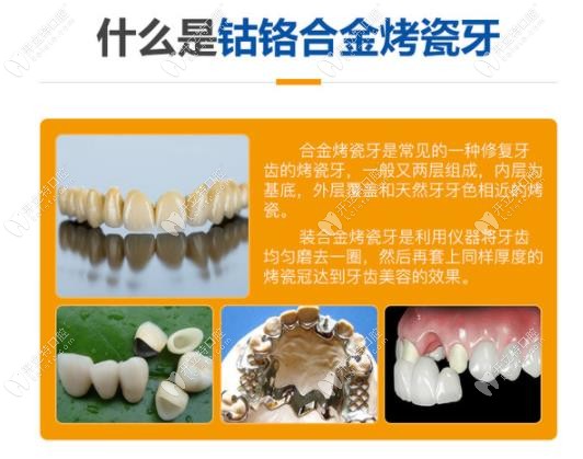 隐形牙图片大全_隐形义齿图片优缺点_单颗活动隐形义牙图片