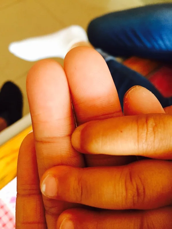 原因手指甲白点上有黑点_我手指甲上有白点什么原因_原因手指甲白点上有白色斑点